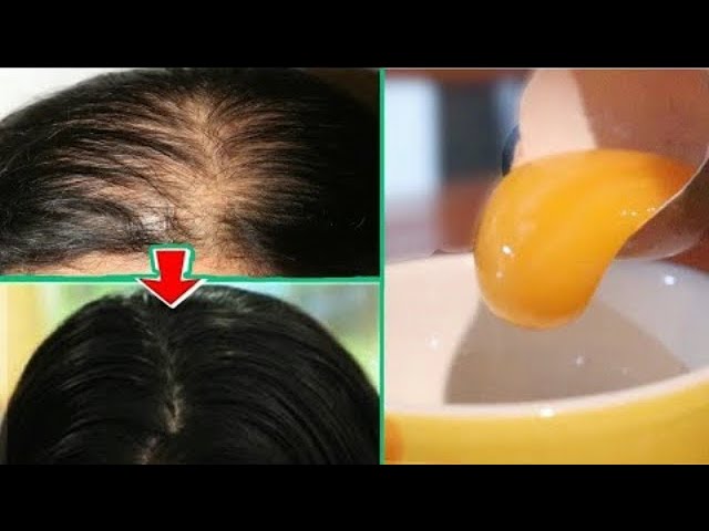 Saç İçin Yumurta Maskesi