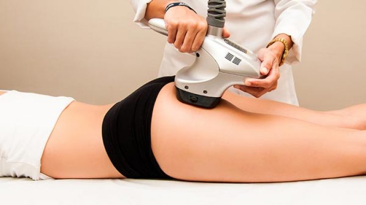 Velashape Nedir? Ne İşe Yarar?